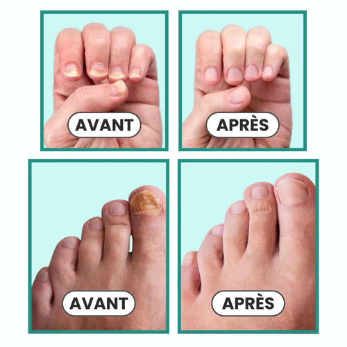 Appareil Onyvia™