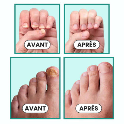 Appareil Onyvia™