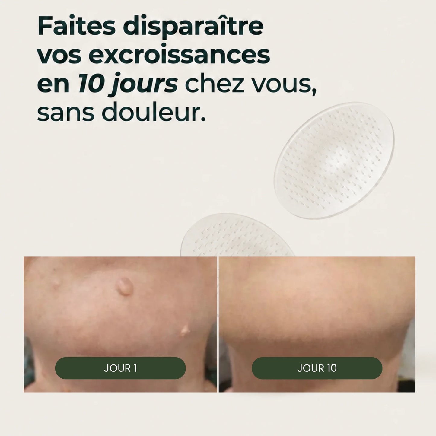 Dermovia™–Micro-Patchs Dermo-Actifs