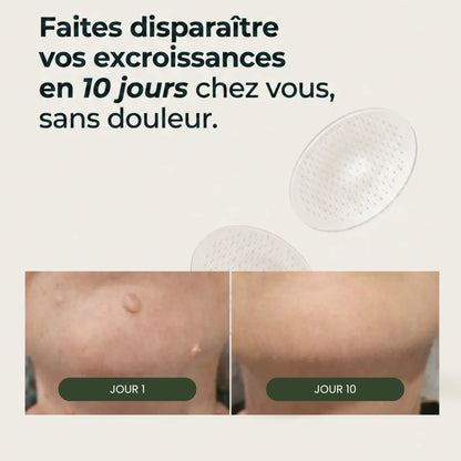 Dermovia™–Micro-Patchs Dermo-Actifs
