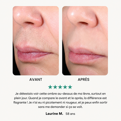 Épilisse™STOP aux poils visibles, aux irritations et à la repousse rapide.