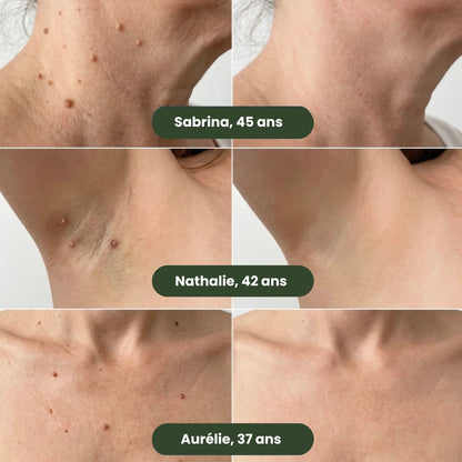 Dermovia™–Micro-Patchs Dermo-Actifs