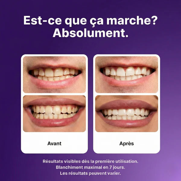 Smilora™, Retrouvez un sourire éclatant en 30 minutes — sans cabinet dentaire