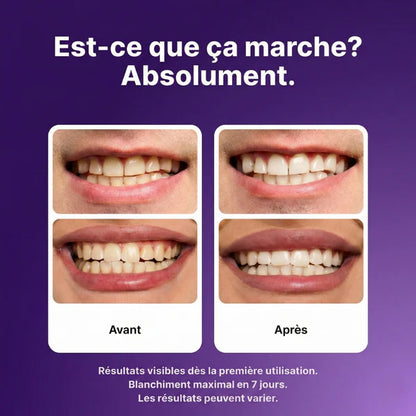 Smilora™, Retrouvez un sourire éclatant en 30 minutes — sans cabinet dentaire