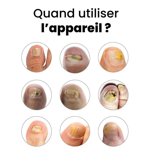 Appareil Onyvia™