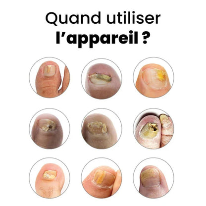 Appareil Onyvia™